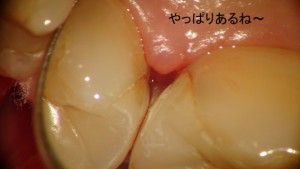 不適合3