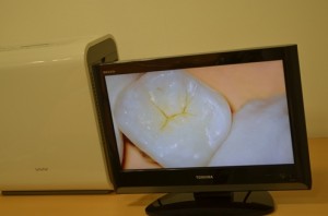 天然歯実習