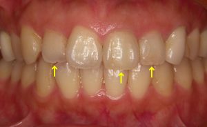 KONICA MINOLTA DIGITAL CAMERA