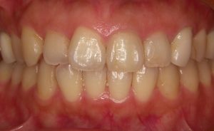 KONICA MINOLTA DIGITAL CAMERA