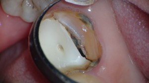 DSC06278
